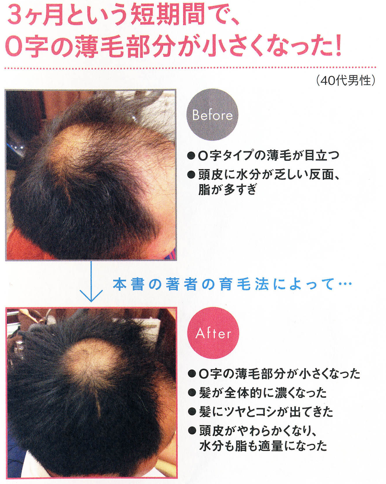 世界一簡単な髪が増える方法 株式会社アスコム